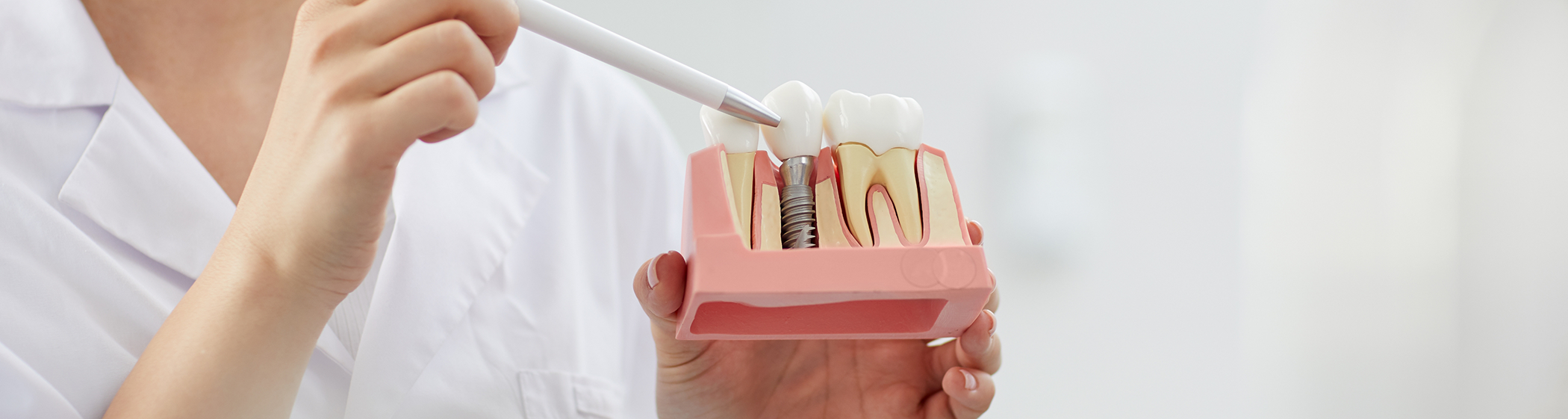 Pointing to model of dental implant with pen